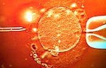 IVF-treatment-sperm-being-006-150x96